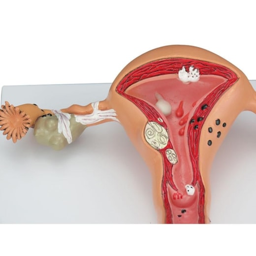 Imagem da galeria de produtos