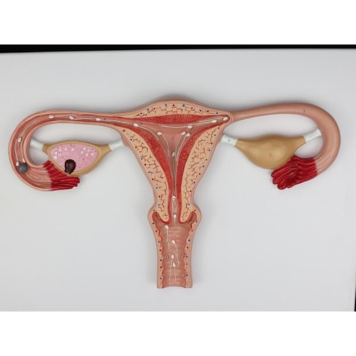 Imagem da galeria de produtos